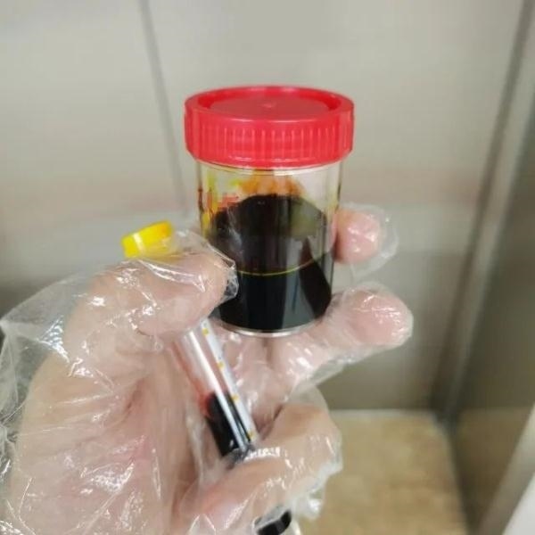 急性肝衰竭！兩兄弟誤吃這種菌 專家提醒